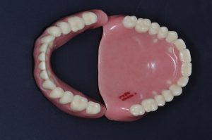 After Dentures