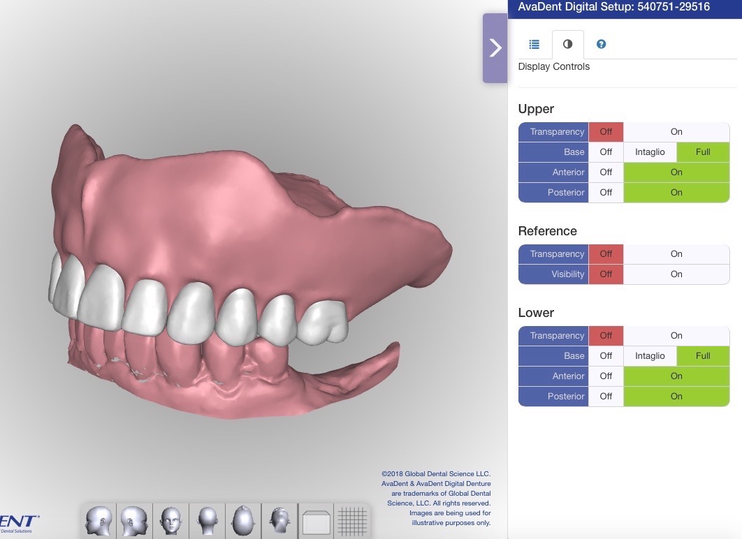 Computer Aided Design for Dentures